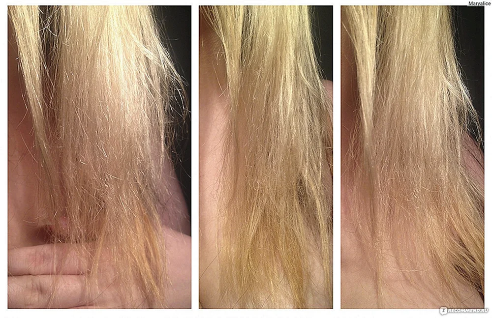 Verbranntes Haar