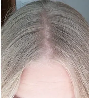 Haare nach Peroxidbleiche