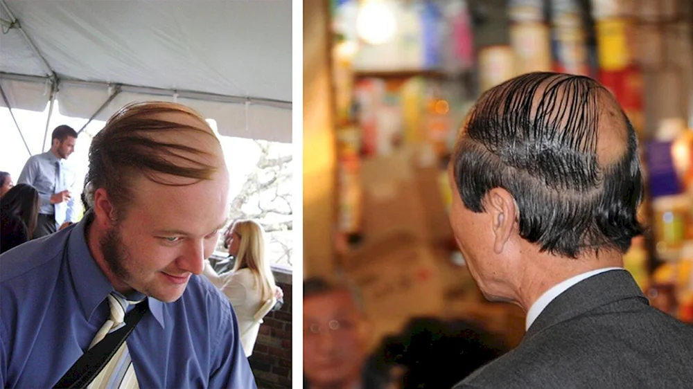 Haare über Glatze gekämmt