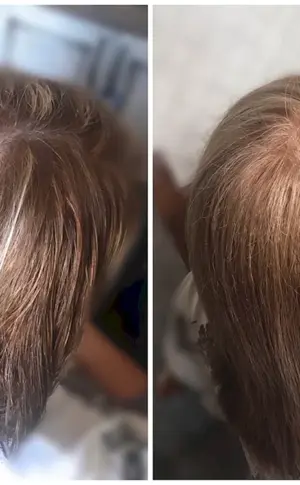 Hair Picks