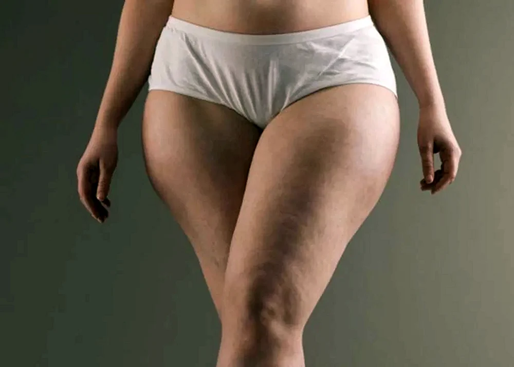 Passende Figur